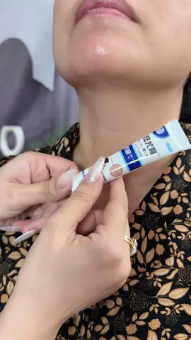 kem hỗ trợ loại bỏ mụn thịt, mụn cóc, mụn ruồi, mụn cơm….