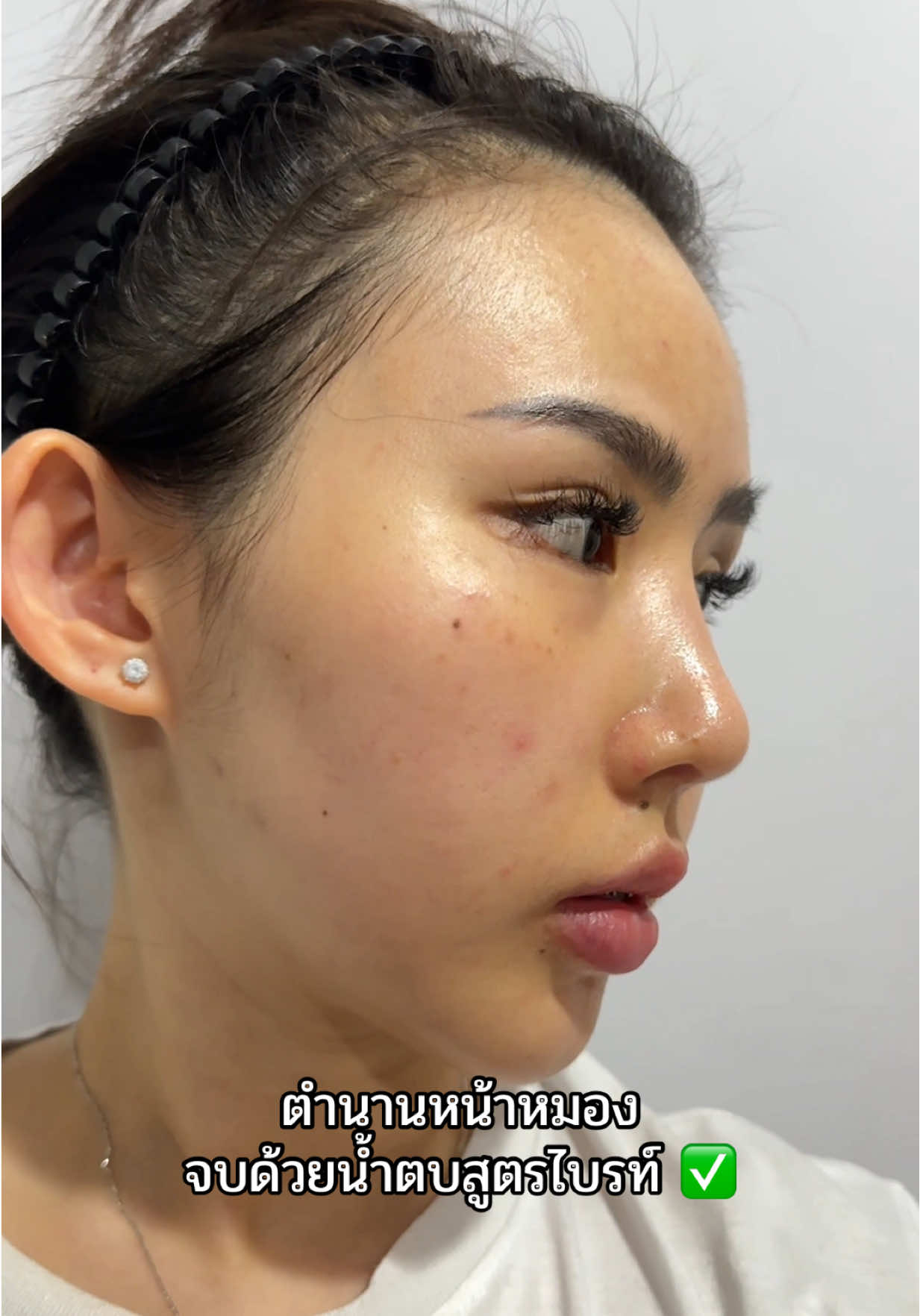 ปิดตำตำนาน #น้ำตบไบรท์ #เปลี่ยนแปลงตัวเอง #ดูแลตัวเอง #น้ําตบลานอส #หน้าใส 