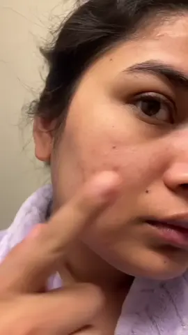 Testing the Viral Dr. Althea 345 Cream: Before & After