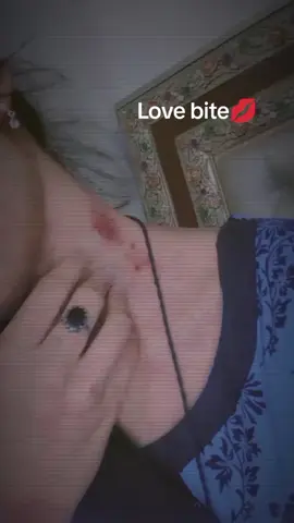 #fypシ゚viral🖤tiktok☆♡🦋myvideo 