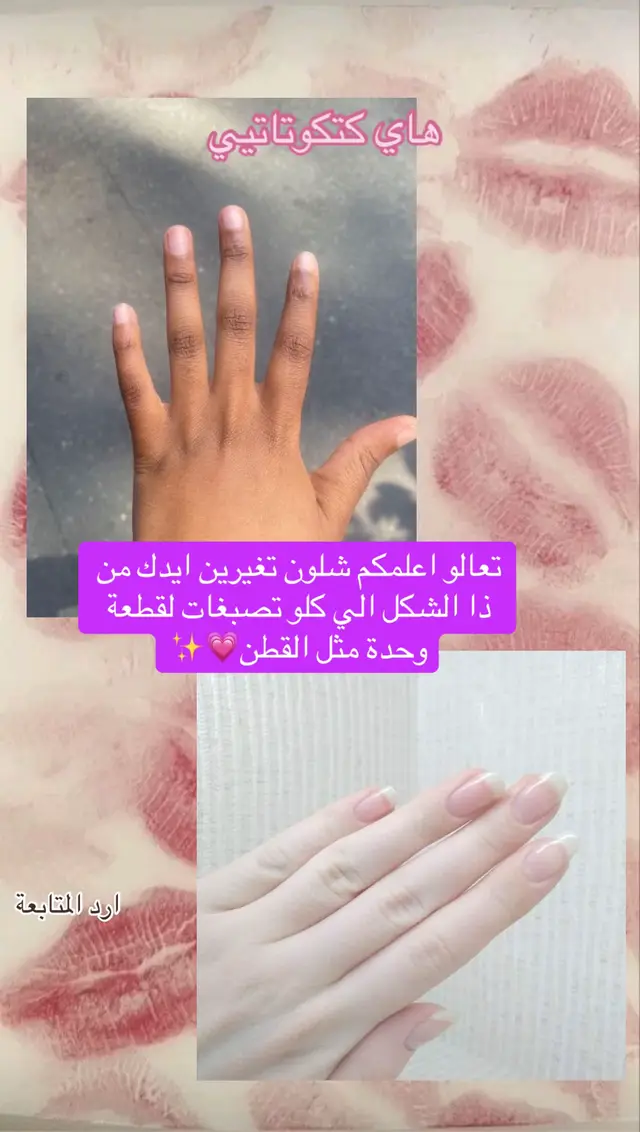 #وصفات_طبيعية #تبييض_البشرة_و_الجسم #تبييض_اليدين 