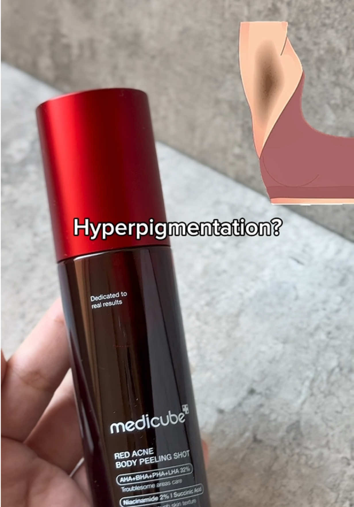 تحفة🫶علاج لكل مشاكل البشرة 👌medicube body peeling red shot مليان مقشرات ومنغير ما يحسس البشرة🫢#viral #fypシ゚ #backacne #medicube #skincare 