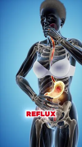 five early signs of Acid reflux that you should not ignore #acidreflux #stomachproblems #gerd #healthtip #usa_tiktok 