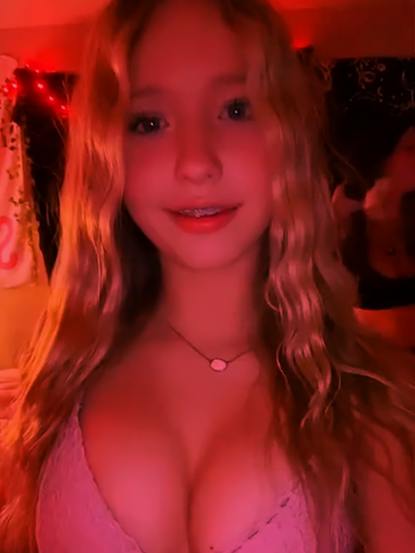 💞💛 💖  💘  💖 💛💞 💟 #bracesarebeautiful #Pheobe White 💘💕 #girlswithbraces  #metalmouth #bracefaced 💟 💞💚💚💖 💘 💖💚💚💞