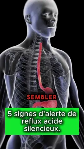 Faites attention au reflux d’acide silencieux ! 🤯 #sante #bienetre #france #apprendresurtiktok #fr 