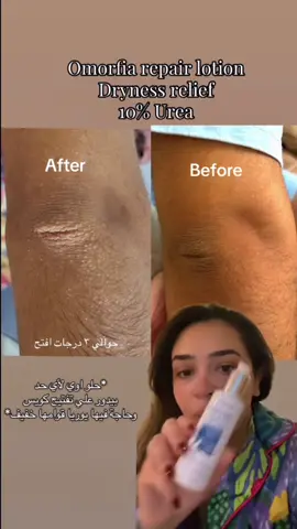 Your skin deserves the best care Experience deep hydration and a soft, silky touch with our OMORFIA Lotion  #Skincare #BodyLotion #glowingskincare . #OMORFIA #SkincareRoutine                              تقدروا تطلبو عن طريق الرسايل او الويب سايت 