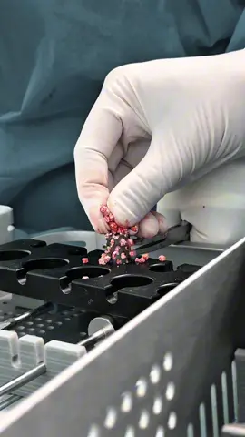 Repairing human neck bone 🔥 #fy #foryou #fyp #foryourpage #fyppppppppppppppppppppppp 