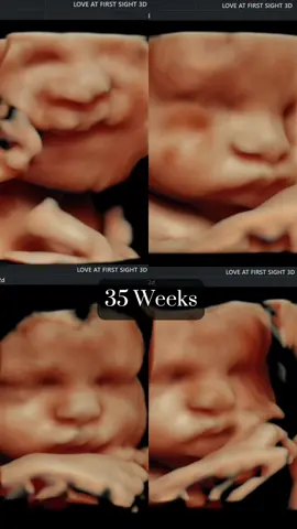 Almost there mama ❤️ this baby was such a joy to scan. Active little guy ✨ #thirdtrimester #baby #4dultrasound #ultrasound 
