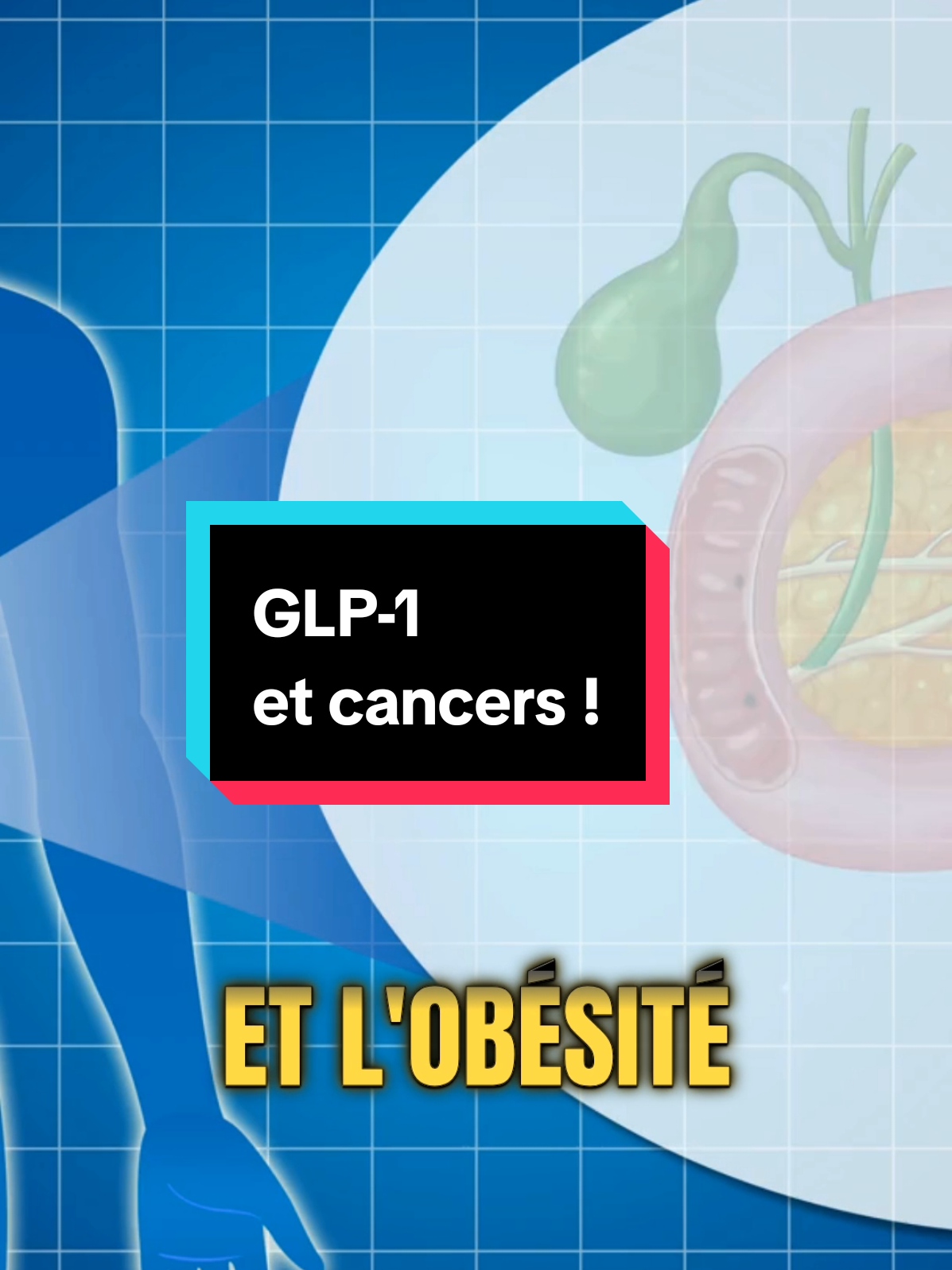 ✨ Vous vous posez des questions sur Ozempi et Wegov ? ✨   Ne laissez pas les rumeurs vous influencer ! De récentes études montrent que ces médicaments n'augmentent pas le risque de cancer colorectal ou pancréatique. En fait, ils pourraient même réduire certains de ces risques en améliorant l'insuline et en réduisant l'inflammation. 📉   Découvrez les faits et prenez des décisions éclairées. Alors, êtes-vous rassuré ? 💬   #cancer #glp1  #Diabète #pertedepoids #BienÊtre
