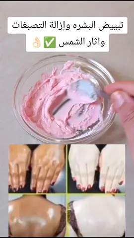 #تبييض الجسم وإزالة التصبغات واثار الشمس #تفتيح-اابسرة#grupocalomx #pubgmmarathon #الجالية_المغربية_في_كل_مكان💚 