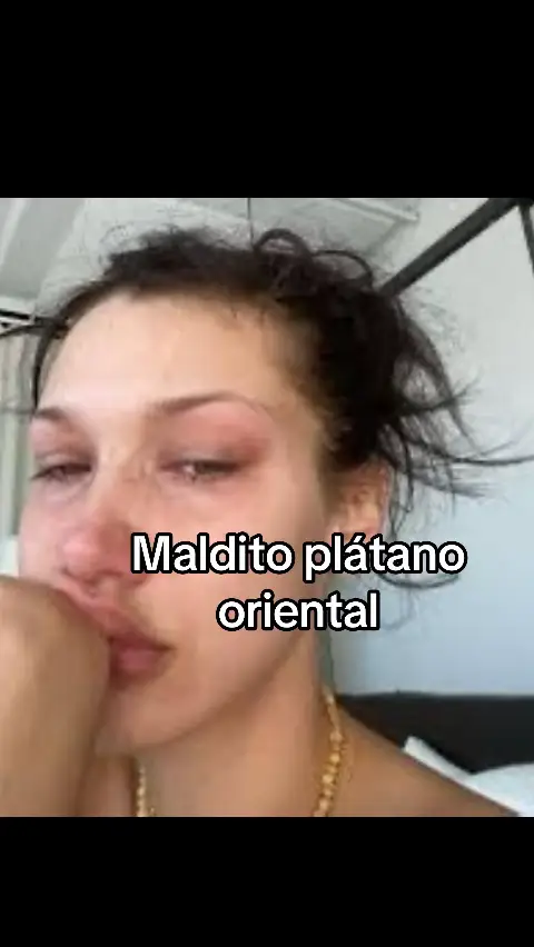 #humor #girls #bellahadid #alergia 