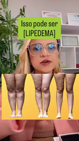 Você já tentou de tudo e nada funciona? Dieta, foco, cortar doce... mas as dores nas pernas continuam? O cansaço só aumenta? A retenção piora ao longo do dia? ⚠️ Pode ser lipedema. Uma condição que vai muito além da estética: causa dores, inchaço, TPM forte, vontade de comer doce, hematomas frequentes e gordura que não some com qualquer dieta ou treino. 💥 Não é preguiça. Não é falta de foco. É uma inflamação silenciosa no seu corpo. É excesso de estrogênio. É desregulação hormonal. ✨ Eu sou nutricionista há mais de 9 anos e também tenho lipedema. Mesmo depois de 3 gestações, ele está estacionado no grau 1, porque eu trato com alimentação estratégica, não com terrorismo nutricional. 🚫 A culpa não é sua. O problema é que seu corpo precisa de um plano alimentar específico para esse tipo de gordura — e não qualquer dieta da internet. 👇 Se esse vídeo falou com você: Comenta “LIPEDEMA” aqui que eu vou te ajudar com os primeiros passos para desinflamar, reduzir dores e recuperar sua qualidade de vida! #lipedema #dieta #alimentacaoantiinflamatoria #emagrecimentosaudavél