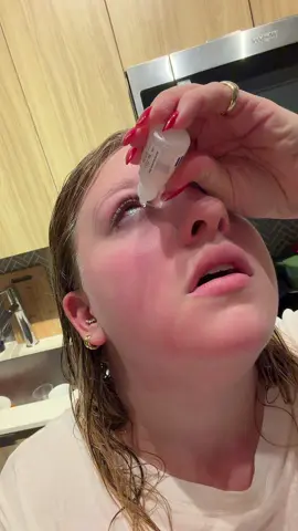 No bc I want a cat #fyp #allergycheck 