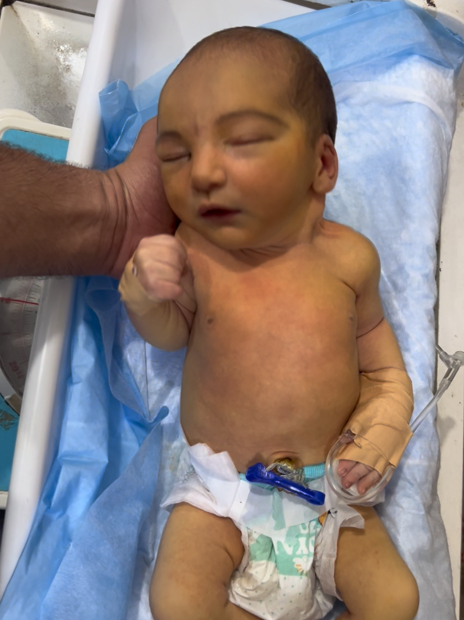 baby no breath no response #please pray for baby #newborn #unfrezmyaccountplz🙏 