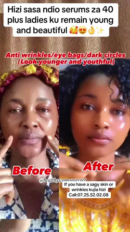 We are located at town Nairobi Imenti house opposite equity shop ZB90 #antiaging #retinol #glassskin #skincare #creatorsearchinsights 