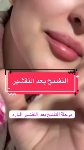 AD @لافمنيت | lafeminite 🌱  #الرياض #اكسبلورexplore #اكرتين #نضارة_البشرة #مالي_خلق_احط_هاشتاقات 