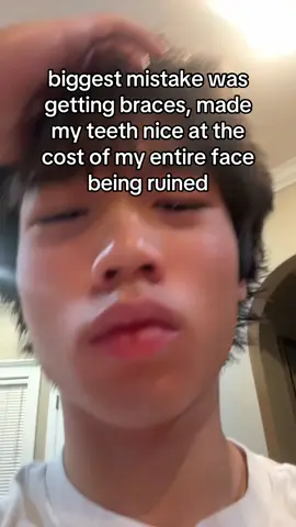 recessed #braces #looks #fypシ #foryoupage #xyzbca 