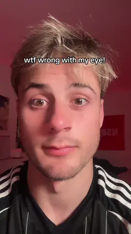 Why me! #fyp #comedy 