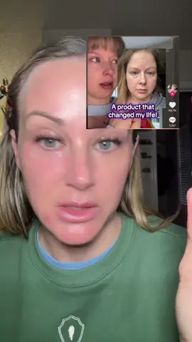 #undereyebags #eyebalm #antiagingskincare #koreanskincare #drmelaxin 