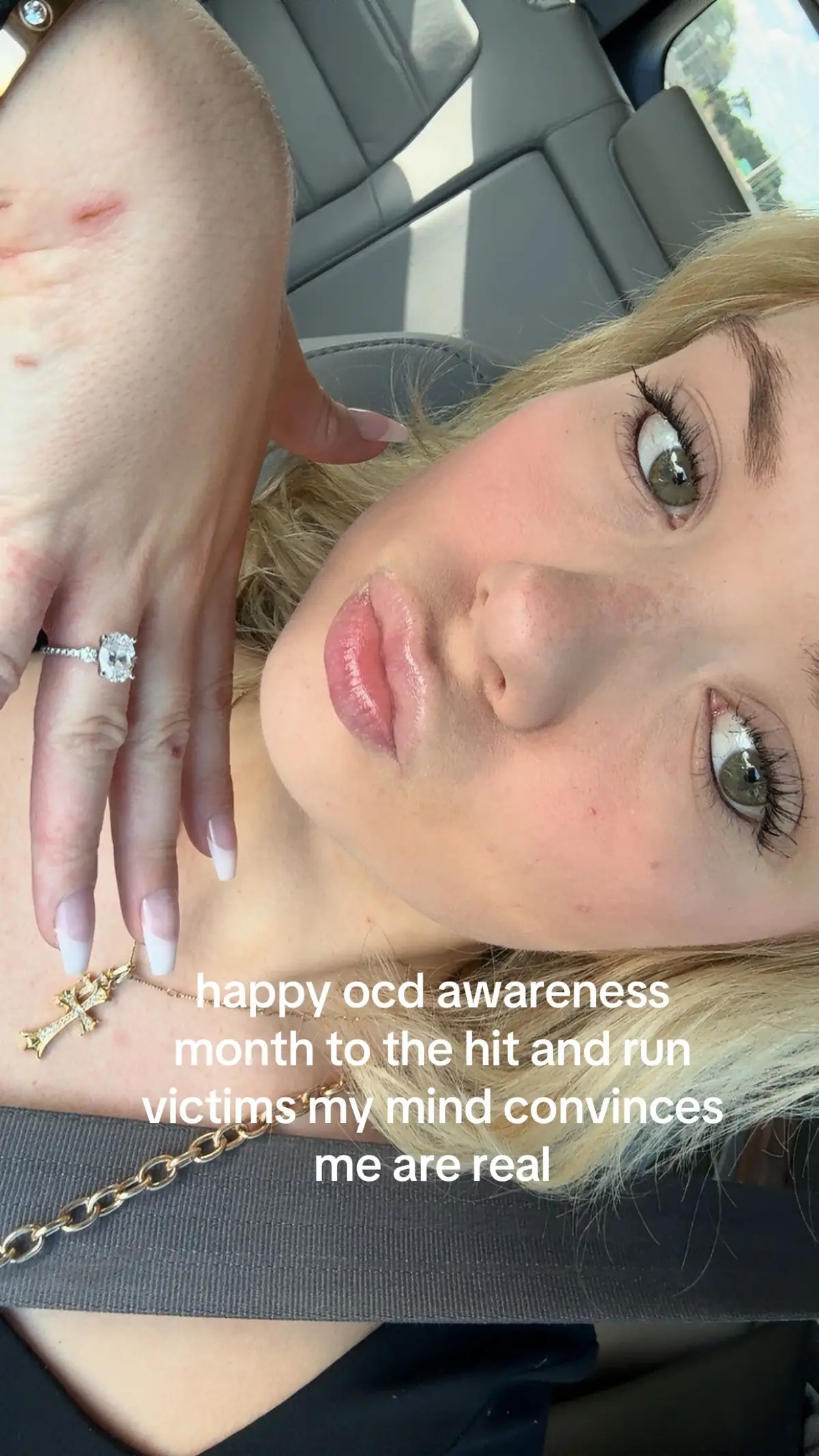 #ocdawareness 