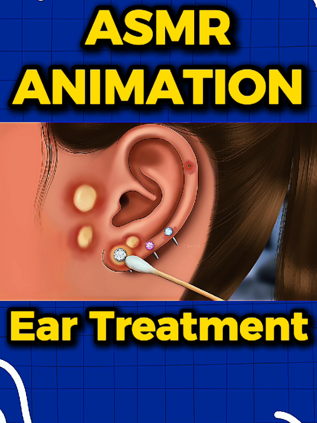 ASMR SATISFYING ANIMATION VIDEO FOR EAR PIERCING TREATMENT ~ #asmr #satisfyingvideo #animation #eartreatment #soonet 