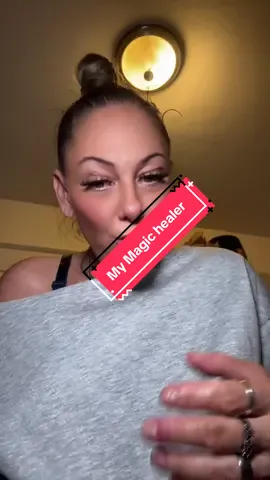 this stuff saved in my hands!! @mymagichealer_usa @MyMagicHealer #mymagichealer #salve #healing #skinconditions #skinhealer 