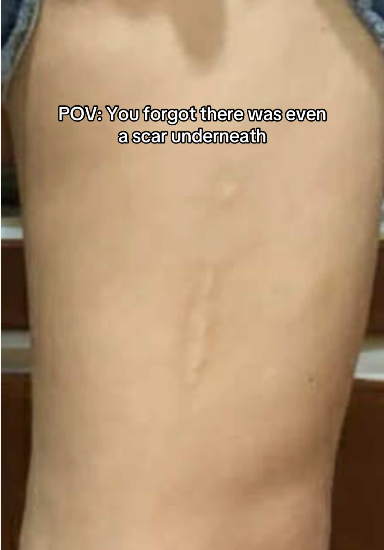 placing art over scars is a beautiful way to cover them up and bring the confidence back! #fyp #femaletattooartist #tatttooideas 