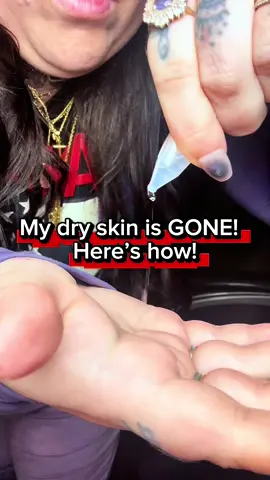 This serum saved my dry skin!  #skincareroutine #hyaluronicacid #dryskinrelief #BeautyReview #glowingskin 