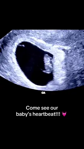 #pregnancy #pregnantlife #ultrasound #firstpregnancy #pregnancyjourney 