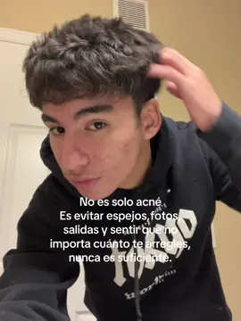 #acne  SI LA GETE EN REALIDAD SUPIERA LO QUE NOSOTROS SIFRIMOS 