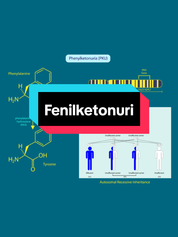 Pernah dengar penyakit yang justru membuat penderitanya diuntungkan? Salah satunya adalah Fenilketonuria, atau disingkat PKU. Fenilketonuria adalah kelainan genetik langka di mana tubuh tidak bisa memecah asam amino bernama fenilalanin—zat yang banyak ditemukan dalam makanan berprotein seperti susu, daging, atau telur. Karena itu, penderita PKU harus menjalani diet sangat ketat sejak kecil, supaya zat tersebut tidak menumpuk dan merusak otak. Namun yang menarik, beberapa ahli berpendapat bahwa dalam situasi kelaparan ekstrem di masa lalu, kondisi ini justru bisa membawa keuntungan evolusioner. Karena metabolisme tubuh penderita PKU lebih lambat, mereka cenderung menghemat energi dan bisa bertahan hidup lebih lama ketika makanan langka. Jadi meskipun sekarang PKU dianggap penyakit yang butuh pengawasan medis ketat, secara tidak langsung ia pernah menjadi contoh bagaimana kelemahan genetik bisa berubah jadi keunggulan, tergantung pada situasi lingkungan. #edukasi #4upage #luftwaffeclan #margasr #fyp 