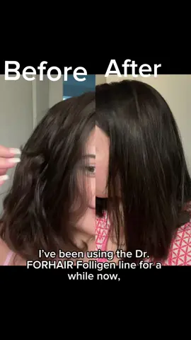 @drforhairus #drforhair #thinninghair #hairloss #hairgrowth #hairtok