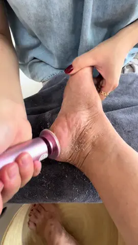 Trà gót chân tại nhà cỡ này mà chưa có đến 200 cành đâu nha #máytragotchan 