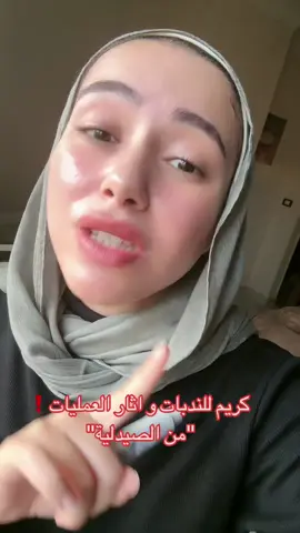 كريم للندبات  و اثار الجروح و العمليات 🌟contracutabex 🫶🏻#scars #scartreatment #skincareviral #skincarehacks #skincaretips 