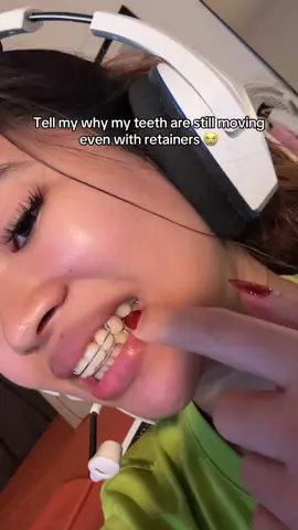 5 years of braces wasted? #bracesfree #hawleyretainer #bracesoff #fyp