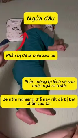 🌟Hóa ra chỉ cần chỉnh lại một chút thôi, đầu con vừa đẹp vừa ngủ dễ chịu hơn 💕  #MẹoChămBé #MẹBỉmNênBiết #TưThếNgủĐúngChoBé #KhôngLoBẹpĐầu 