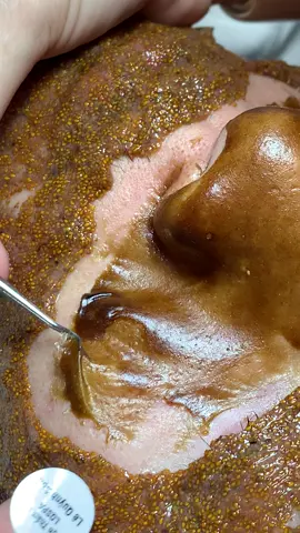 Nâu#chamsocdamun#chamsocdanam#chamsocdaseo#lequynhspa#hocnghespa 