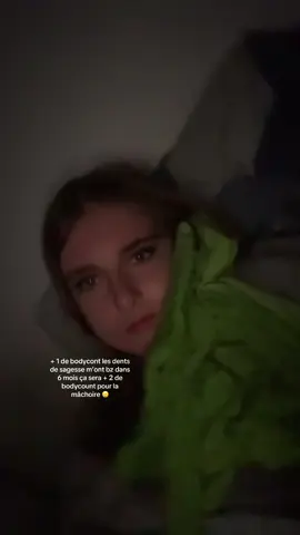ça fait mal les mâchoires ou pas ? #pourtoi#dentdesagesse#operation 