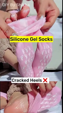 پہلے چیک کریں پھر پیسے دیں Moisturizing Socks - Silicone Socks for Dry Cracked Feet Women [Allow To Open} {Free Delivery} What's App  03074076030
