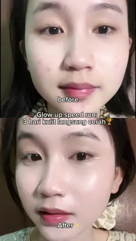 Glow up 3 hari?😩