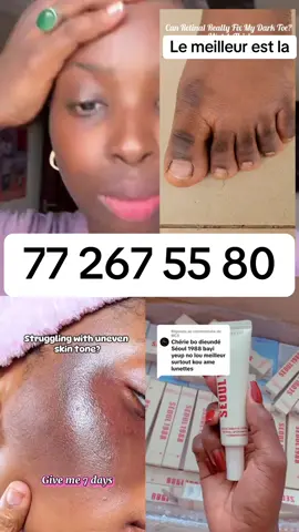 #senegalaise_tik_tok🇸🇳pourtoichallenge #senegalaise_tik_tok #foryourpage #senegalaise_tik_tok🇸🇳 #kolda #saintlouissenegal #dakar #kaolack #beauty #kolda #louga #cosmetics 