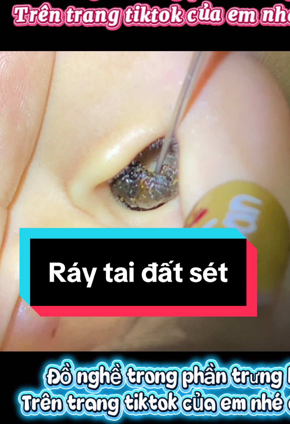 Trả lời @Đỗ Đức Nghĩa trong phần trưng bày trên trang em nhé bác#ráytai #xuhuong #tronghoanbarbershop 