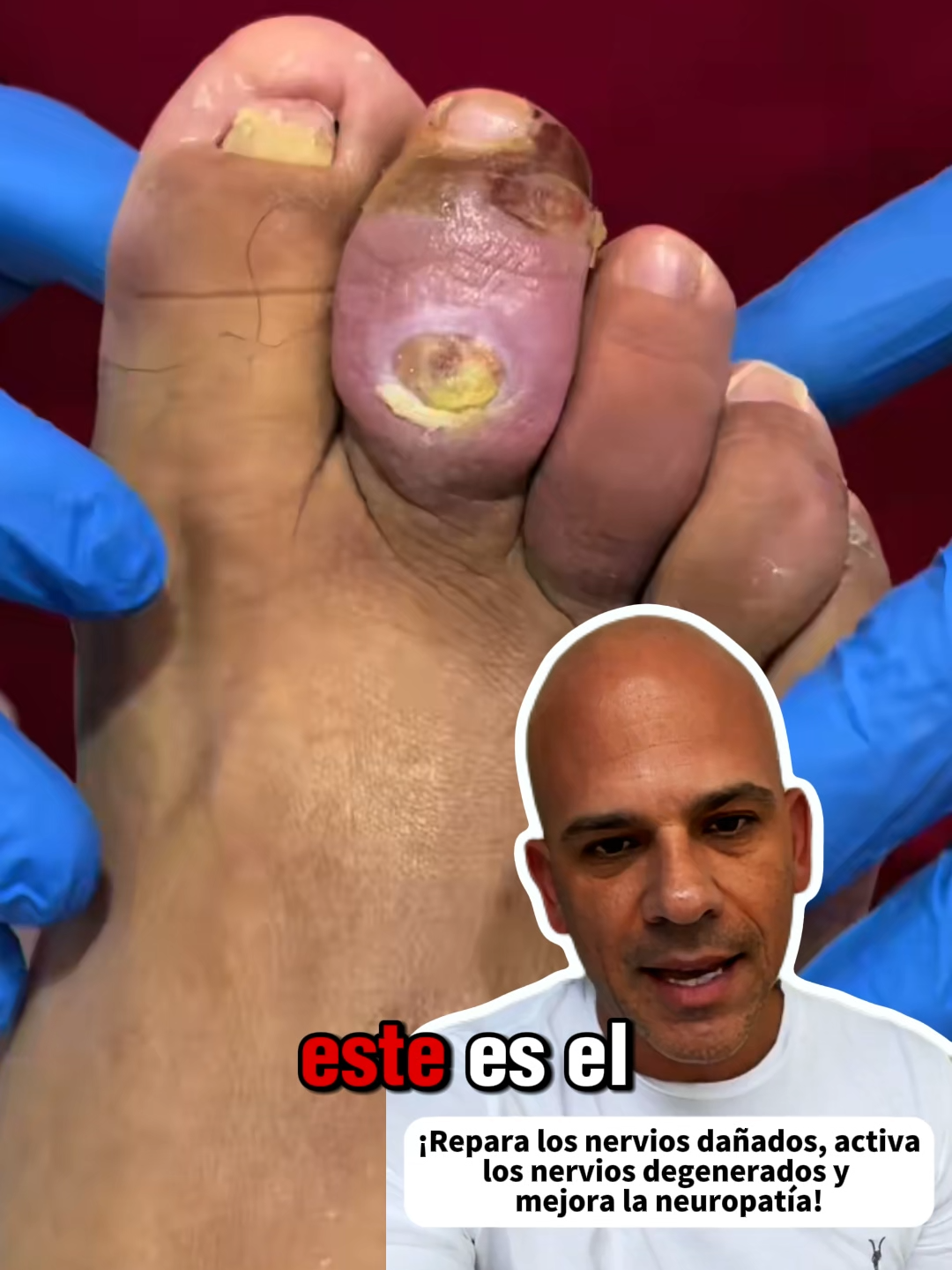 #legpain #tiktokshoprestock #40old #neuropathy