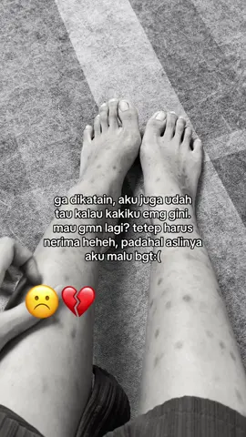 gaada yang mau kaya gini plss🥹🥹🥹 #korengan #bekasluka #penghilangbekasluka 