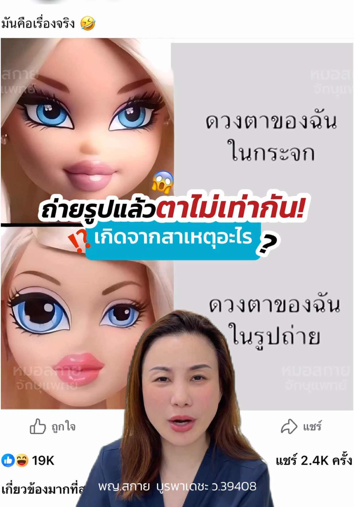 ถ่ายรูปแล้ว #ตาไม่เท่ากัน ‼️ เกิดจากอะไร? #ความรู้ #ปัญหาโลกแตก #หมอสกาย #จักษุแพทย์