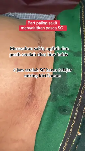 Konsumsi kapsul ikan gabus bantu penyembuhan luka sesar #fypシ゚ #fyp #bidan 