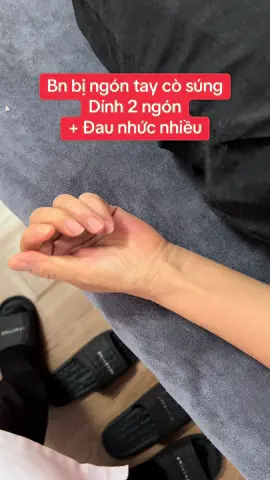 Hội chứng ngón tay cò súng (Trigger finger): là tình trạng viêm, dày hoặc xơ hóa bao gân gấp (A1 pulley), khiến gân gấp ngón tay bị kẹt lại khi trượt qua bao gân, gây ra cảm giác “khấc” hoặc “cò súng” khi gấp – duỗi ngón tay. 	•	Khi kèm dính hai ngón tay (thường là do viêm lan hoặc dính gân chung ở vùng bàn tay), chứng tỏ: 👉 Viêm bao gân lan rộng, có thể dính phần mô mềm xung quanh. 👉 Gân gấp bị xơ dính, hạn chế trượt, gây đau nhức, co cứng, khó cử động.#ngontaycosung #nhanamyvien #bsnguyenxuanhung 