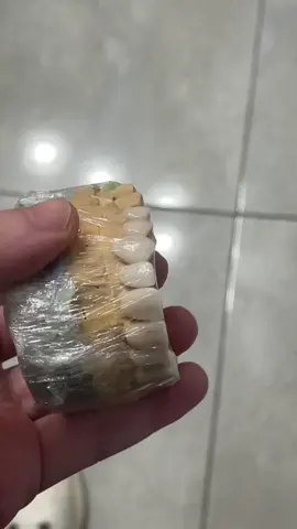 Ceramic veneers 