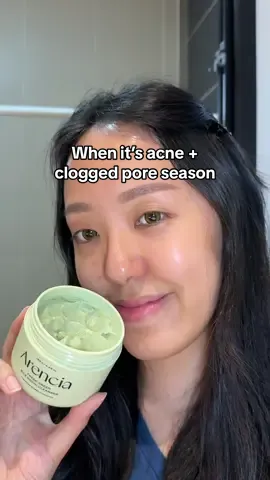 Ugh it’s acne season and my skin is feeling so clogged. I’m using the Arencia Fresh Green Mochi Cleanser tonight for a gentle exfoliation and cleansing. Can see redness is calmed and skin is smoother after @Arencia  #MochiGlowUp #Arencia #acnecleanser #ArenciaMochiGlowUp #koreanskincare 