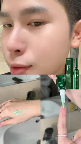 Peel da mà sưng đỏ bây giờ là xưa dữ lắm rồi mấy anh chị ơi 💚💚💚 #mqskin #tuyendoan #peelsangda #xh 